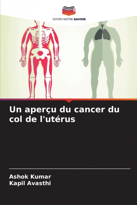 Un aperçu du cancer du col de l’utérus