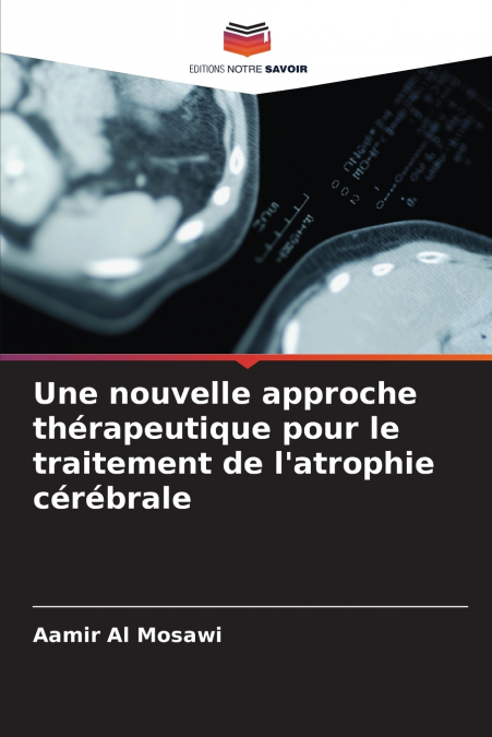 Une nouvelle approche thérapeutique pour le traitement de l’atrophie cérébrale