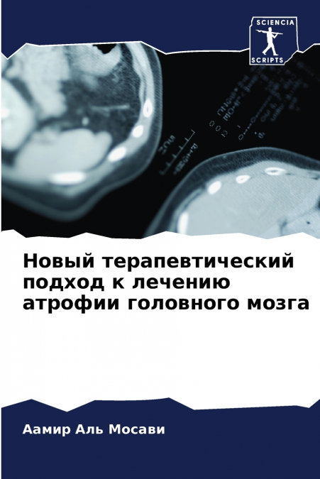Новый терапевтический подход к лечению атрофии головного мозга