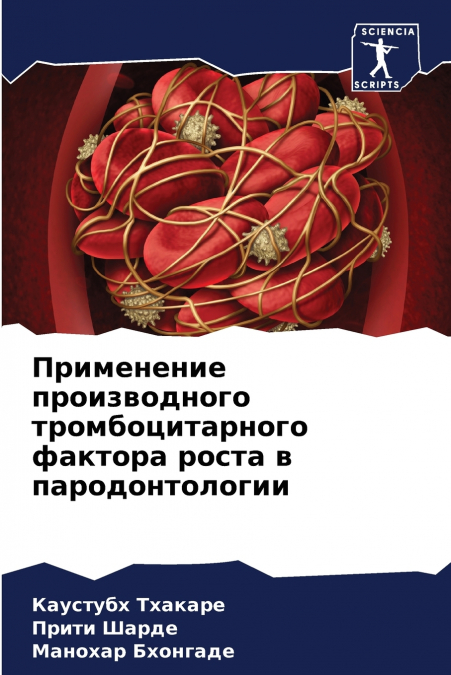Применение производного тромбоцитарного фактора роста в пародонтологии