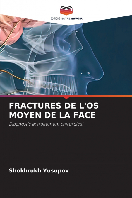 FRACTURES DE L’OS MOYEN DE LA FACE
