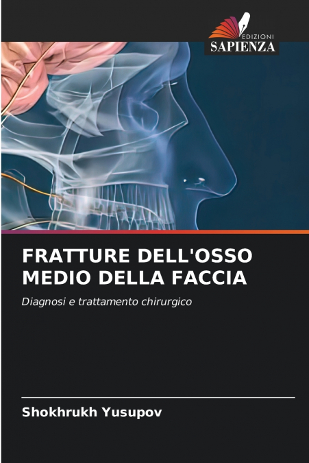 FRATTURE DELL’OSSO MEDIO DELLA FACCIA