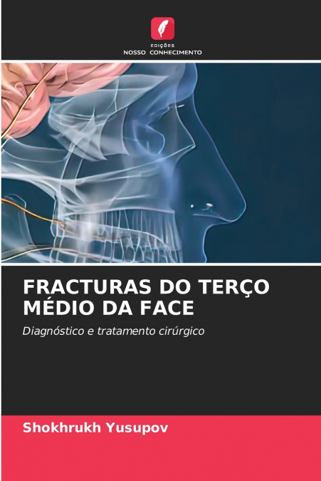 FRACTURAS DO TERÇO MÉDIO DA FACE