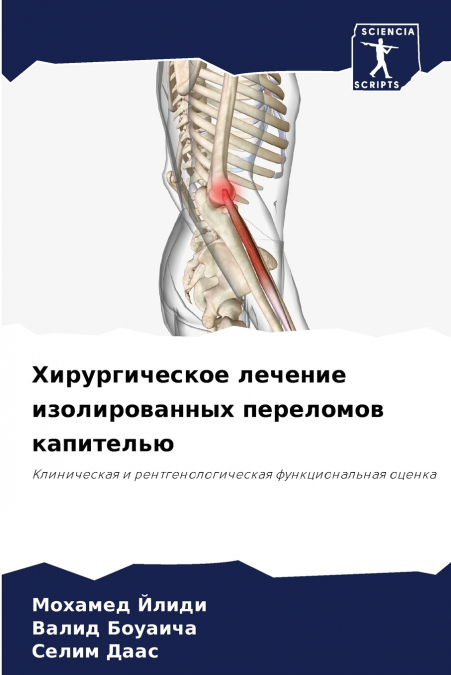 Хирургическое лечение изолированных переломов капителью