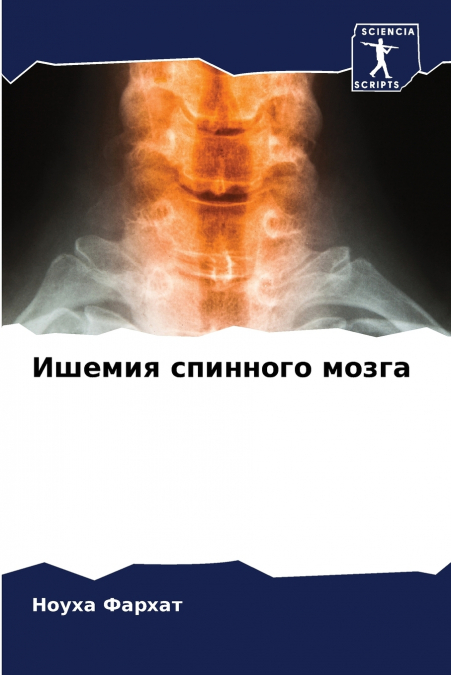 Ишемия спинного мозга