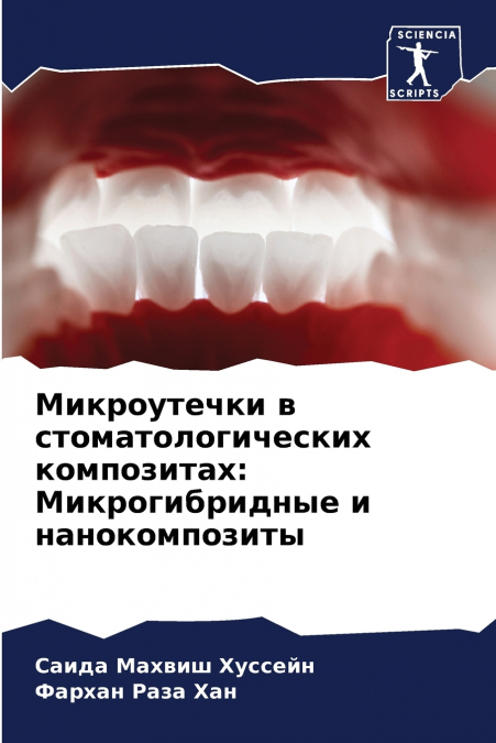 Микроутечки в стоматологических композитах