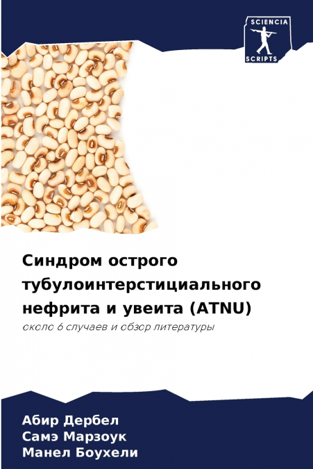 Синдром острого тубулоинтерстициального нефрита и увеита (ATNU)