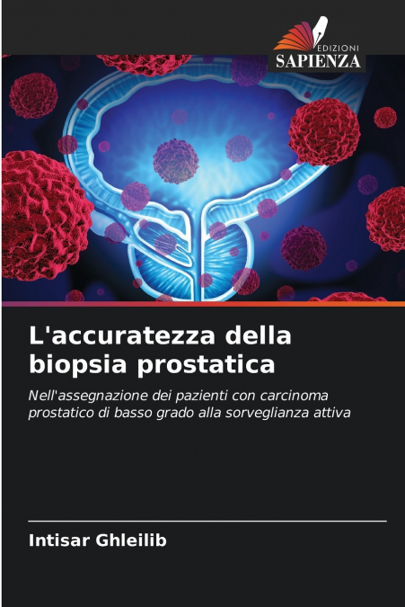 L’accuratezza della biopsia prostatica