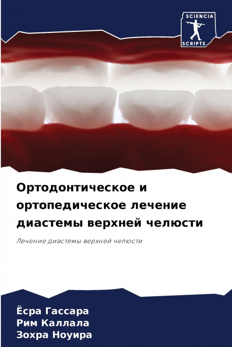 Ортодонтическое и ортопедическое лечение диастемы верхней челюсти