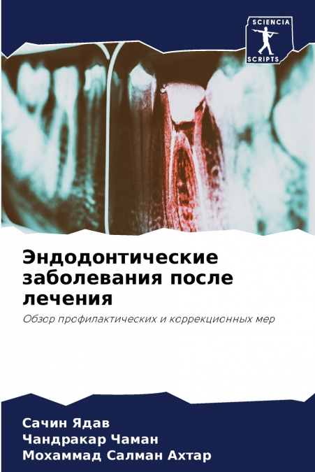 Эндодонтические заболевания после лечения