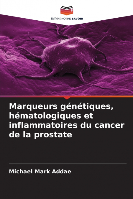 Marqueurs génétiques, hématologiques et inflammatoires du cancer de la prostate