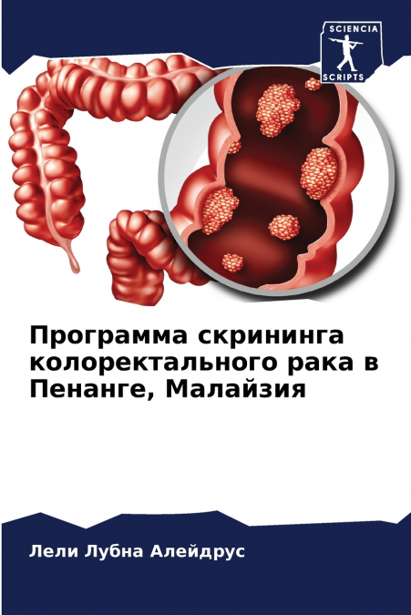 Программа скрининга колоректального рака в Пенанге, Малайзия