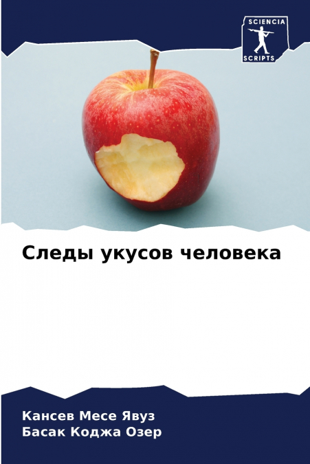 Следы укусов человека