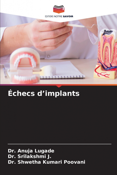 Échecs d’implants