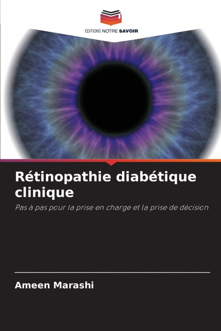 Rétinopathie diabétique clinique