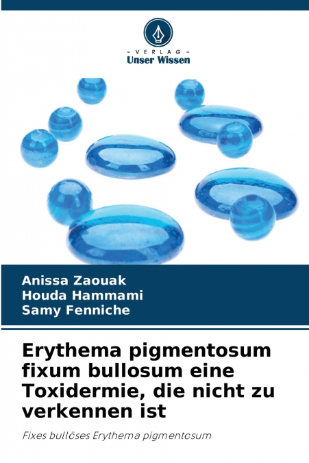 Erythema pigmentosum fixum bullosum eine Toxidermie, die nicht zu verkennen ist