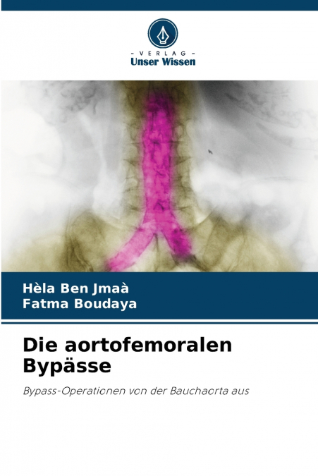 Die aortofemoralen Bypässe