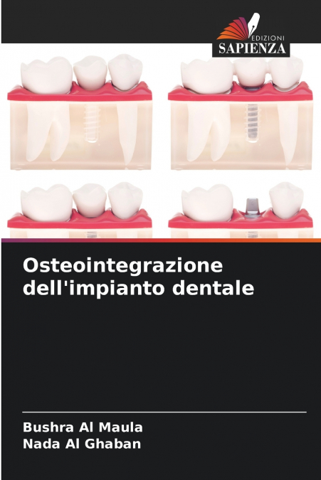 Osteointegrazione dell’impianto dentale