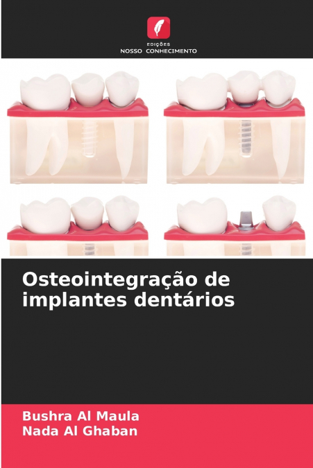 Osteointegração de implantes dentários