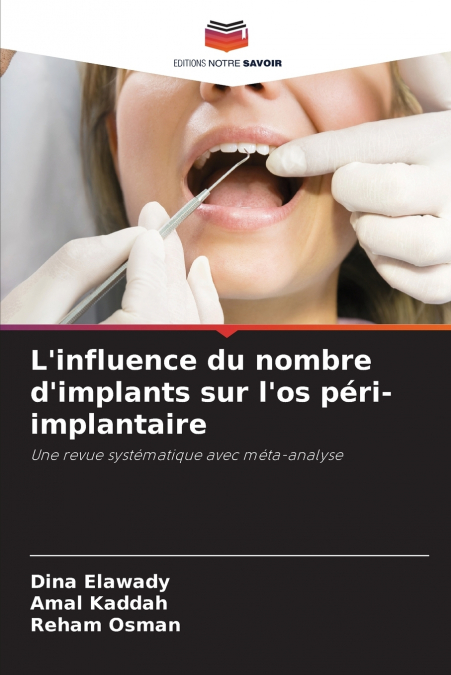 L’influence du nombre d’implants sur l’os péri-implantaire