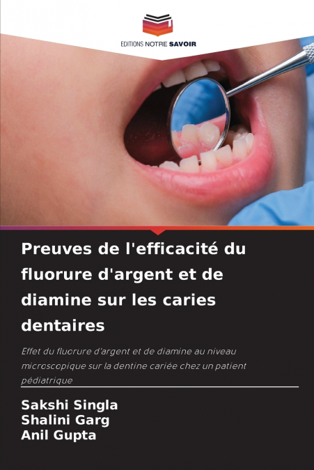 Preuves de l’efficacité du fluorure d’argent et de diamine sur les caries dentaires