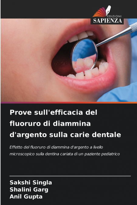 Prove sull’efficacia del fluoruro di diammina d’argento sulla carie dentale