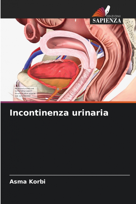 Incontinenza urinaria