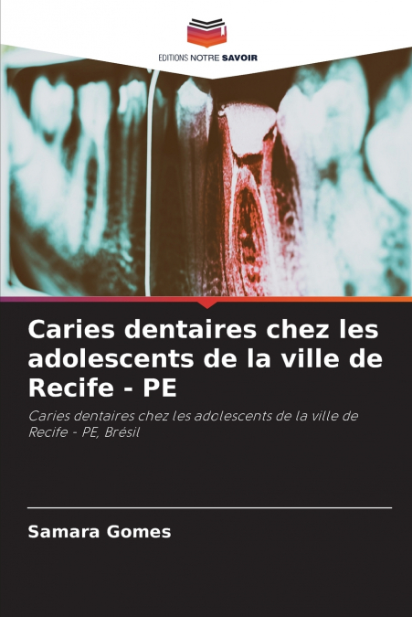 Caries dentaires chez les adolescents de la ville de Recife - PE