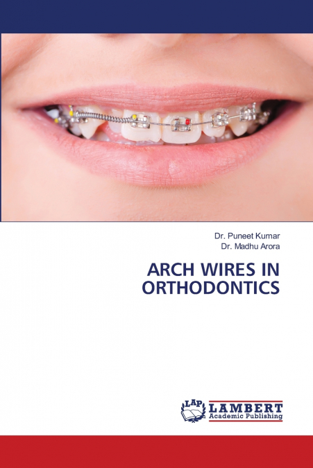ARCH WIRES IN ORTHODONTICS
