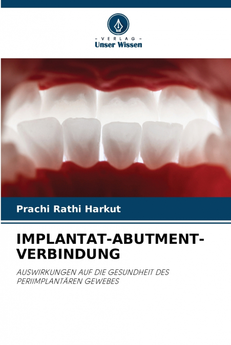 IMPLANTAT-ABUTMENT-VERBINDUNG