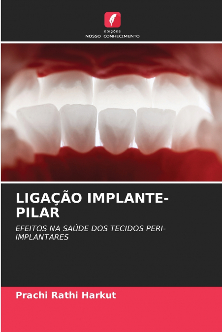 LIGAÇÃO IMPLANTE-PILAR