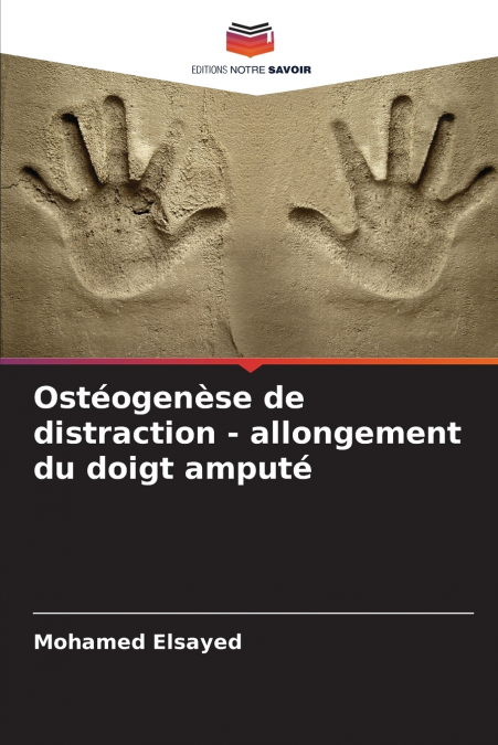 Ostéogenèse de distraction - allongement du doigt amputé