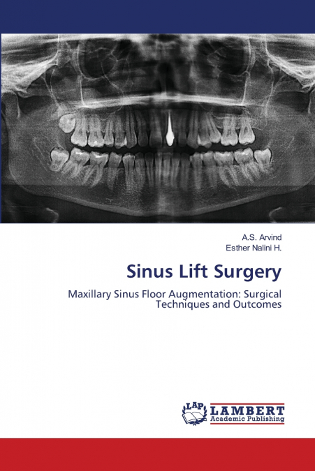 Sinus Lift Surgery