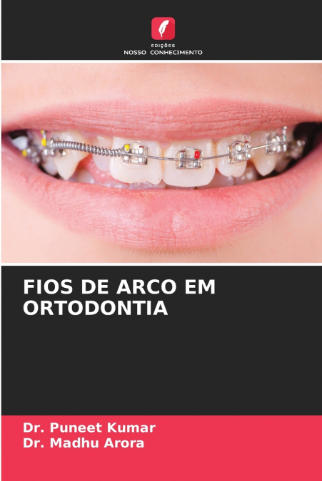 FIOS DE ARCO EM ORTODONTIA