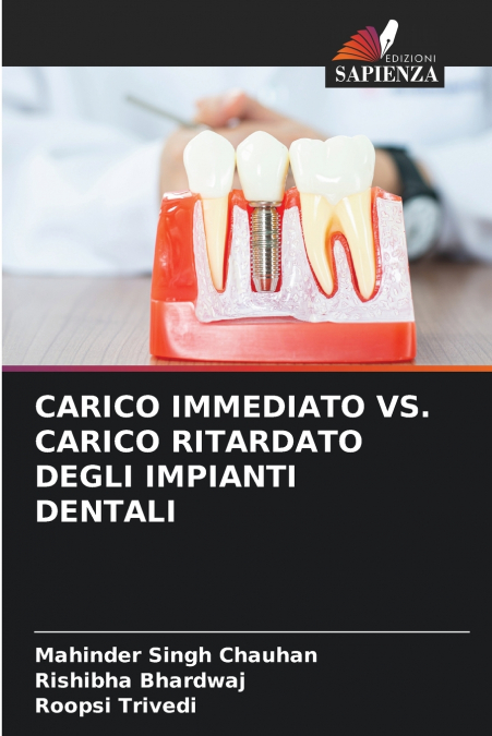 CARICO IMMEDIATO VS. CARICO RITARDATO DEGLI IMPIANTI DENTALI