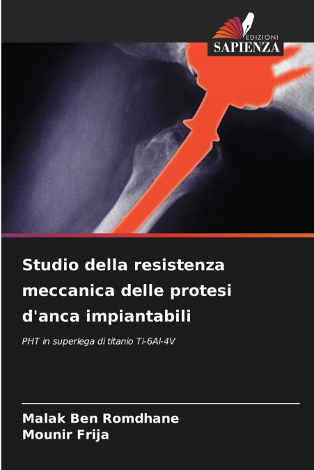Studio della resistenza meccanica delle protesi d’anca impiantabili