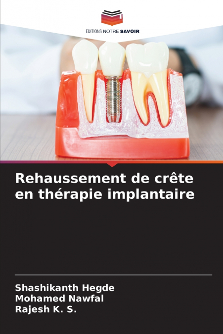 Rehaussement de crête en thérapie implantaire
