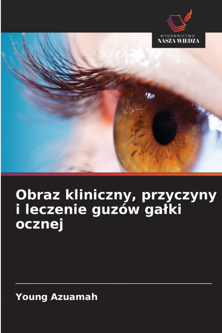 Obraz kliniczny, przyczyny i leczenie guzów gałki ocznej