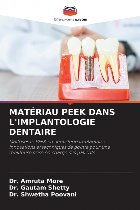 MATÉRIAU PEEK DANS L’IMPLANTOLOGIE DENTAIRE