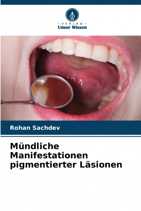 Mündliche Manifestationen pigmentierter Läsionen