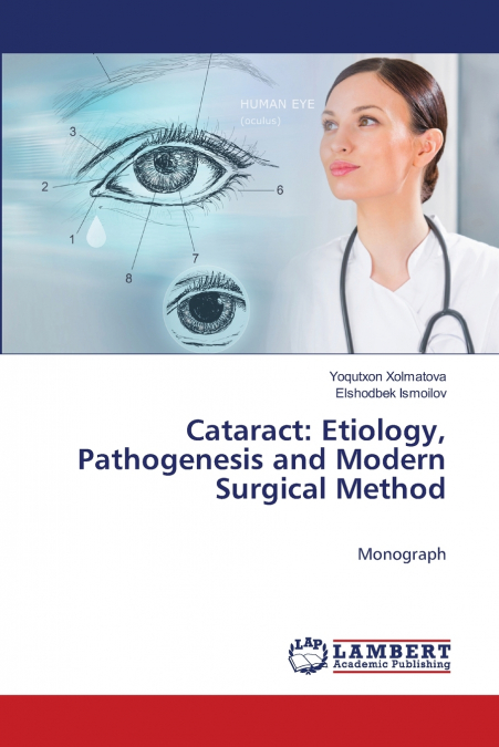 Cataract