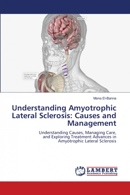 Understanding Amyotrophic Lateral Sclerosis