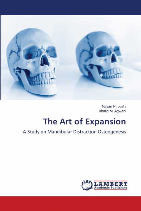 The Art of Expansion