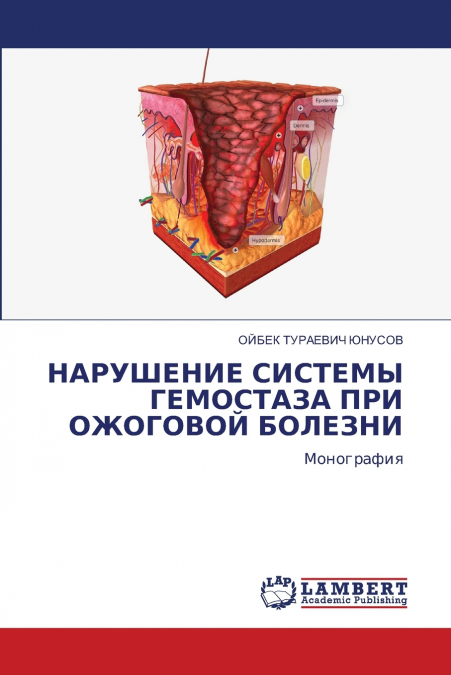 НАРУШЕНИЕ СИСТЕМЫ ГЕМОСТАЗА ПРИ ОЖОГОВОЙ БОЛЕЗНИ