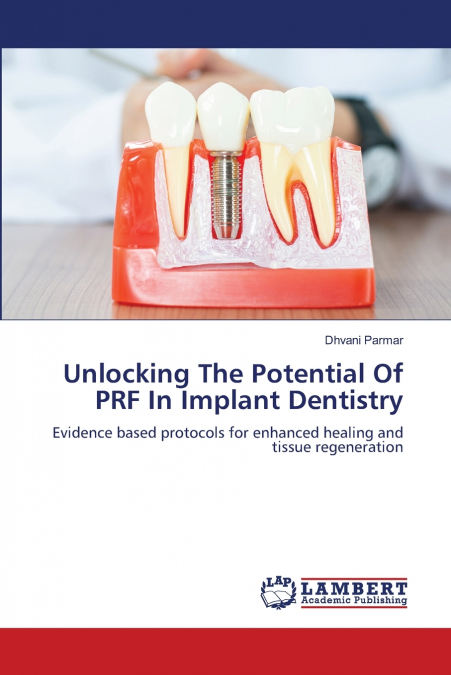Unlocking The Potential Of PRF In Implant Dentistry