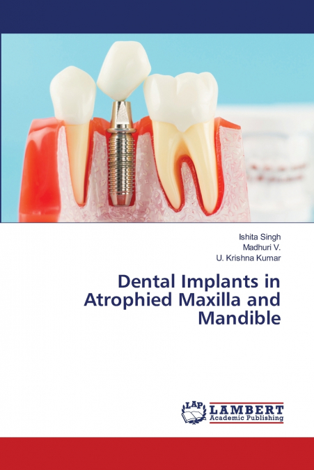 Dental Implants in Atrophied Maxilla and Mandible
