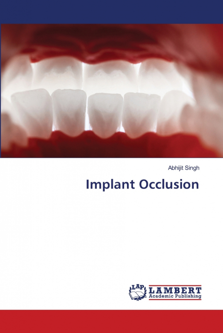 Implant Occlusion
