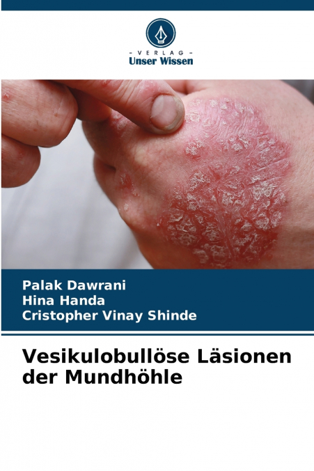 Vesikulobullöse Läsionen der Mundhöhle