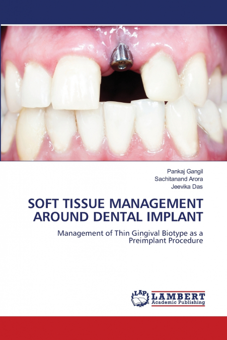 SOFT TISSUE MANAGEMENT AROUND DENTAL IMPLANT