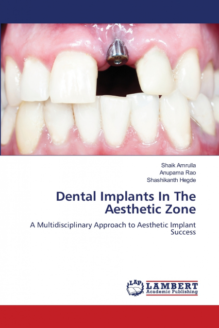 Dental Implants In The Aesthetic Zone